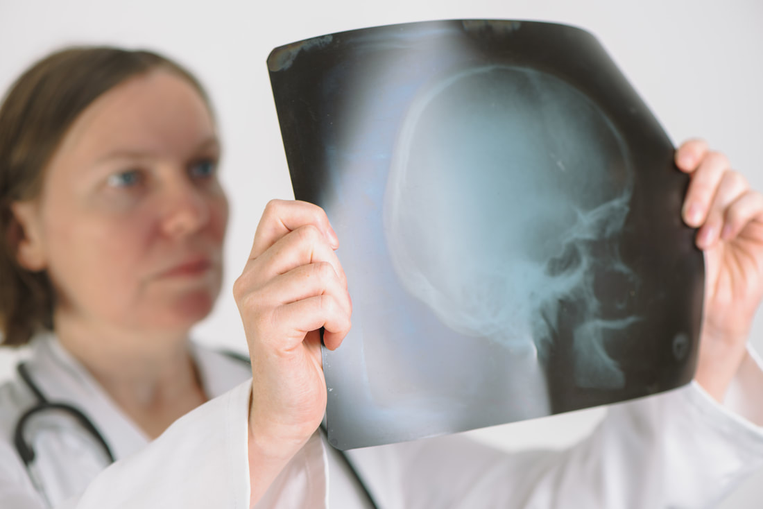 doctor is looking at head x-ray